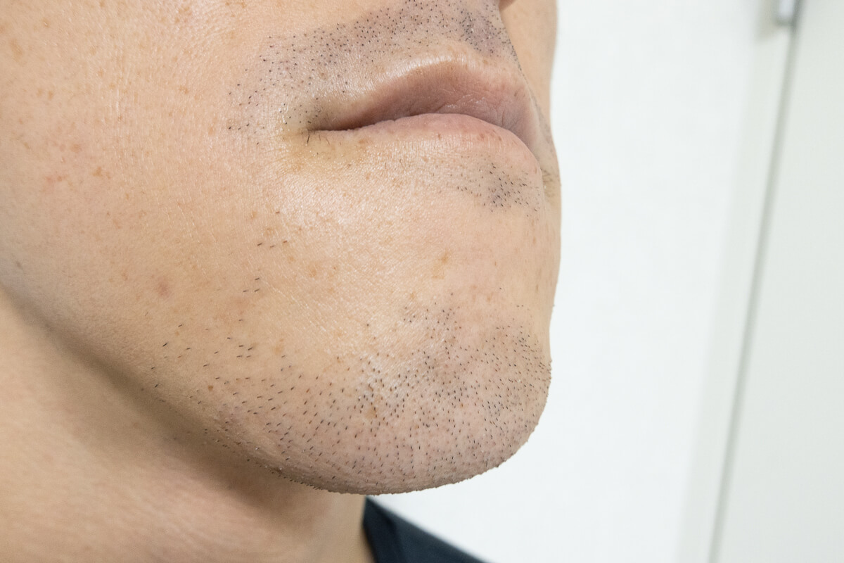 ヤーマン レイボーテ メンズフラッシュzero 使用レビュー 1ヶ月使ってヒゲへの効果を検証 Rentio Press レンティオプレス